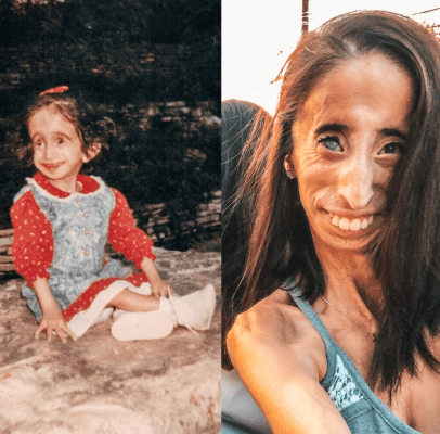 The story of Lizzie Velásquez – this is her today in 2024