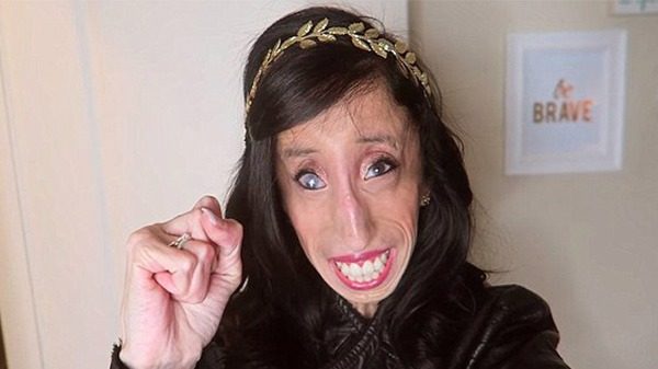 The story of Lizzie Velásquez – this is her today in 2024