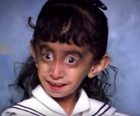 The story of Lizzie Velásquez – this is her today in 2024