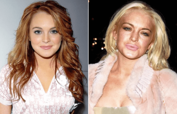 How plastic surgery changed these celebrities