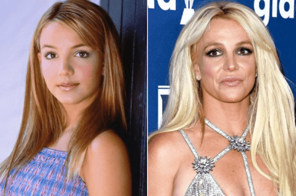 How plastic surgery changed these celebrities