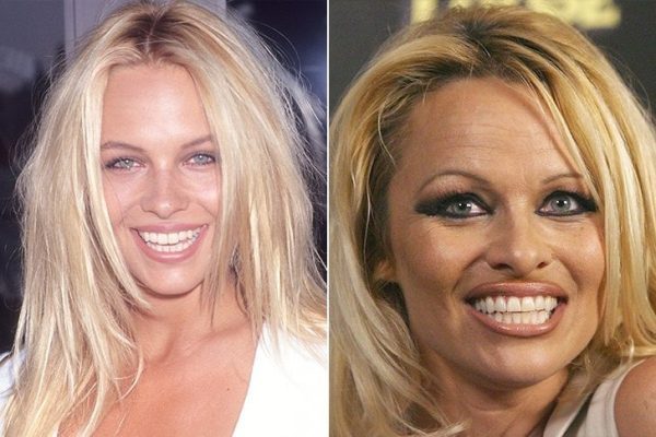 Celebrities Who Have Undergone Significant Transformations Over Their Lifetime