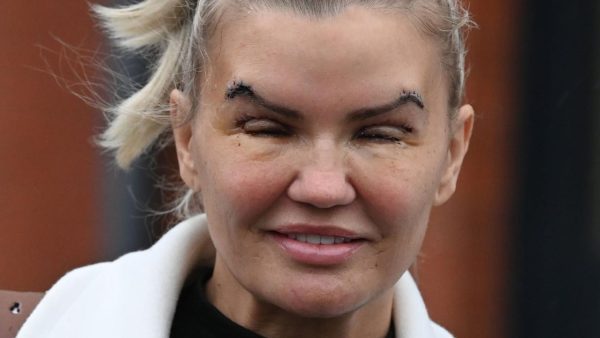 Remember Kerry Katona? Take A Deep Breath Before See Her Now
