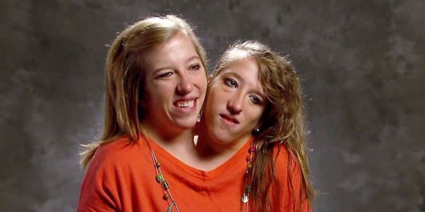 Inside the Unique World of Conjoined Twins Abby and Brittany