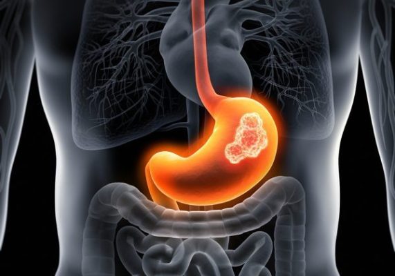 These signs in the mouth may conceal stomach cancer